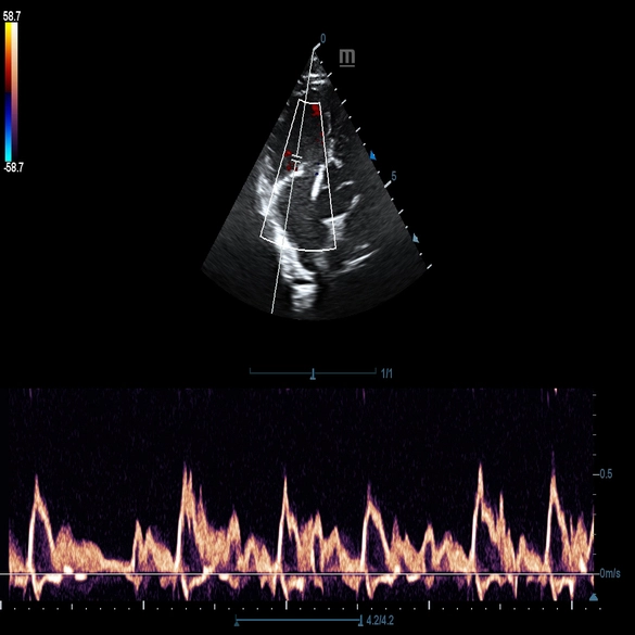 DP 50 Vet - Digital Ultrasonic Diagnostic Imaging System